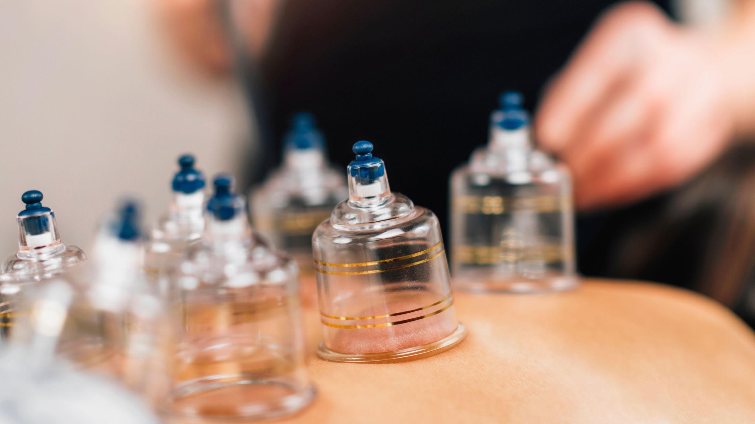 Cupping Therapy Pittsburgh — Heal Pgh Acupuncture and Massageworks